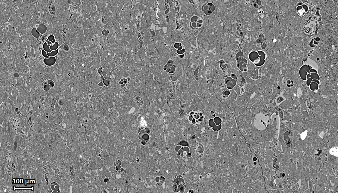 Microtomography slice through a piece of shale rock with foraminifera inclusions, acquired with a pixel size of 0.65 µm - beamline ANATOMIX Microtomography slice through a piece of shale rock with foraminifera inclusions, acquired with a pixel size of 0.65 µm - beamline ANATOMIX