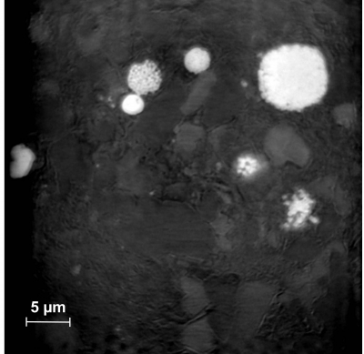 Grayscale image representing a sagittal tomography slice, with scale bar; area approx. 45 microns diameter